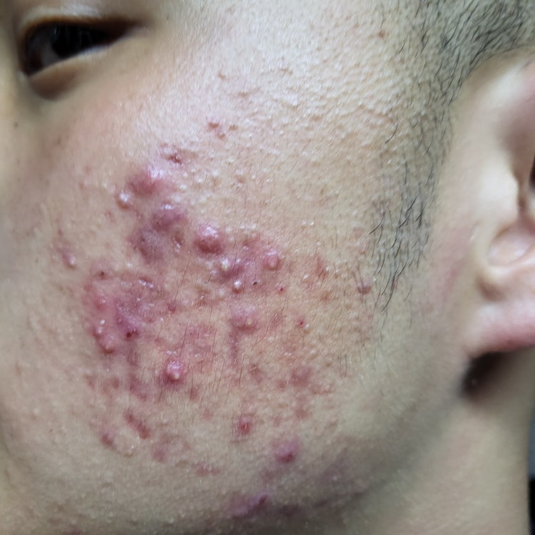 "Je veux contrôler l’excès de sébum, pas camoufler.