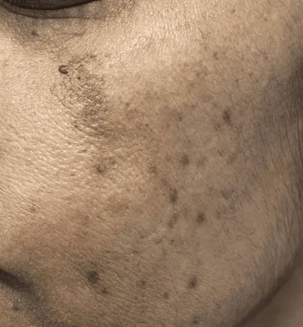 Je veux retrouver un teint clair et harmonieux.